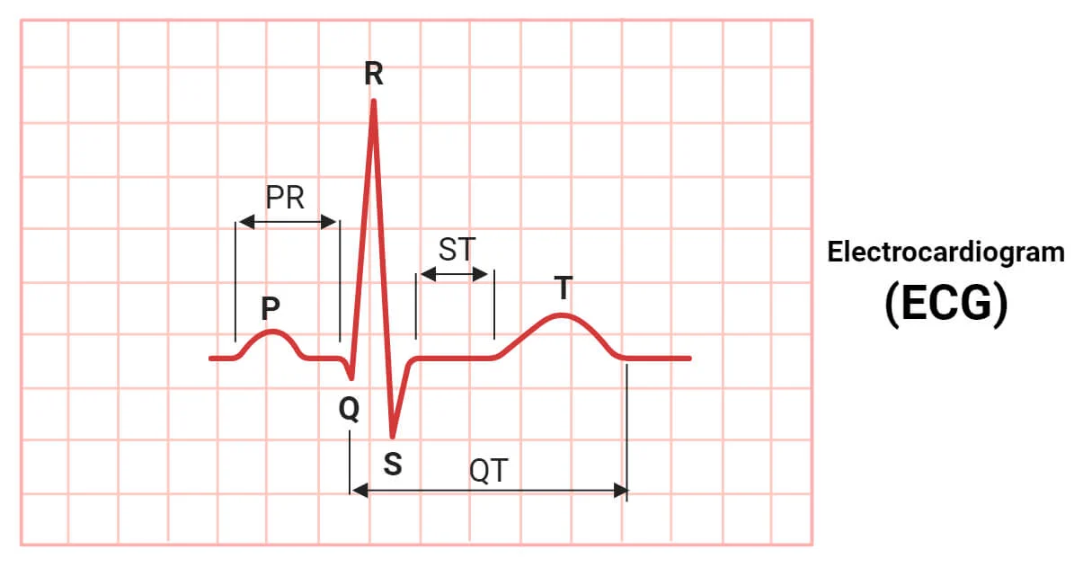 ECG